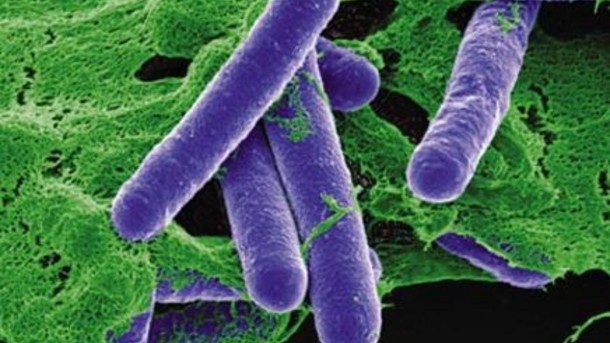 Clostridium botulinum